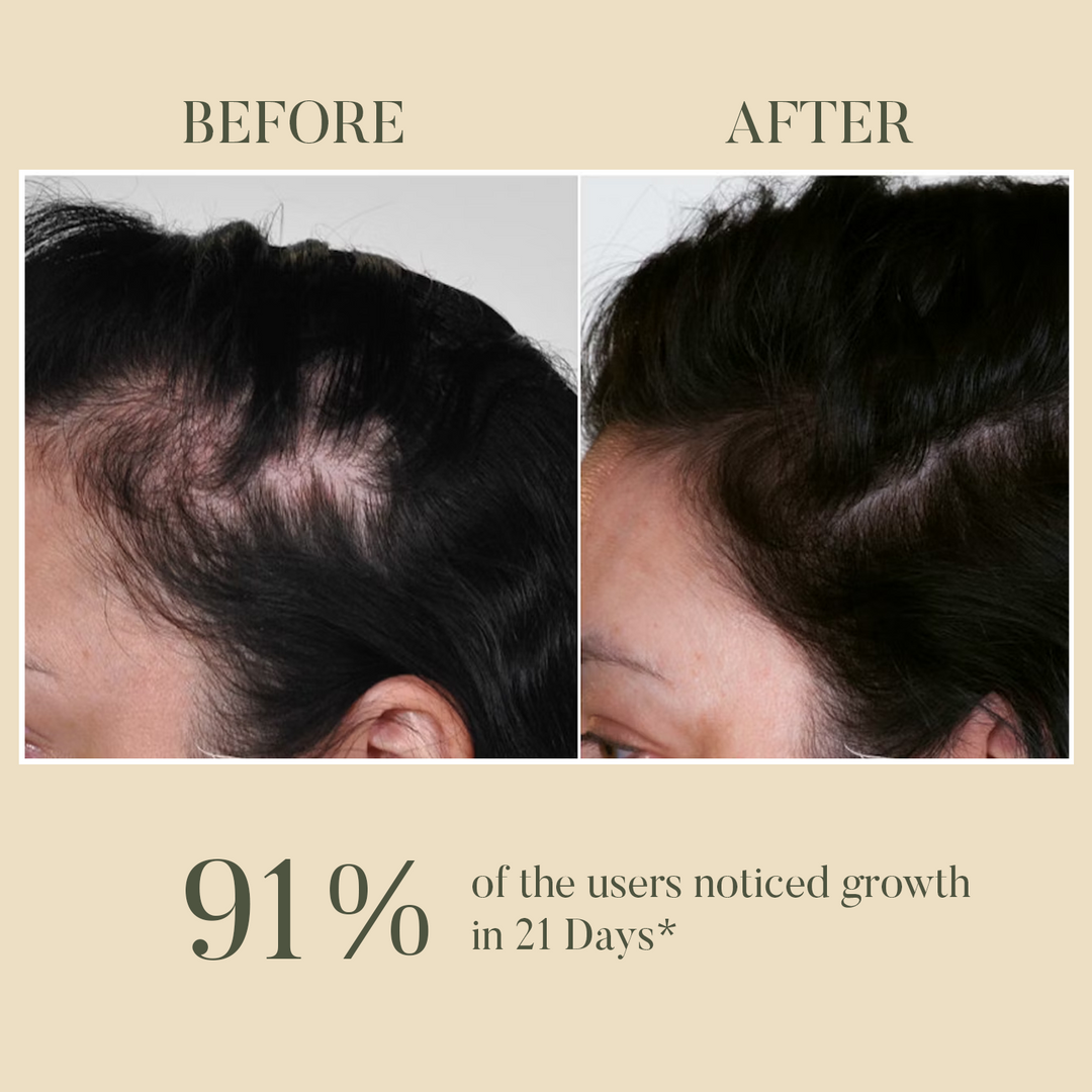 The Ultimate Skin & Hair Growth Tool OHRIA AYURVEDA